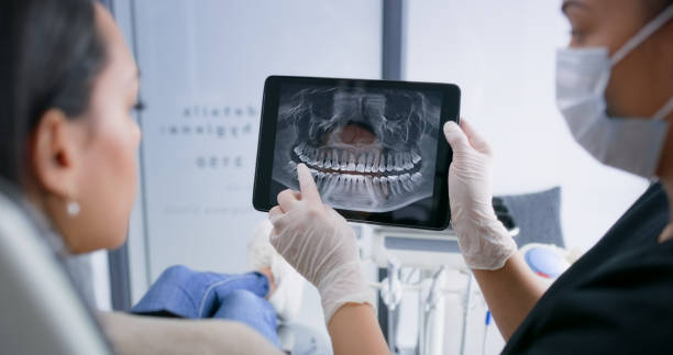 Licensed Tooth Extraction service in Rochester, NH - Smile Center Dentistry